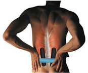 Low Back Pain Kinesio Taped
